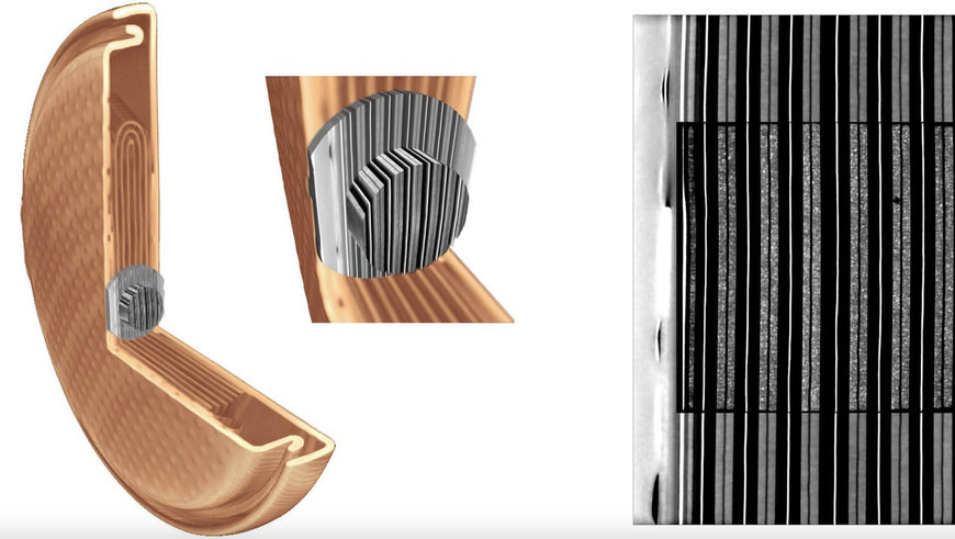 PRECISION AND EFFICIENCY IN 3D X-RAY MICROSCOPY